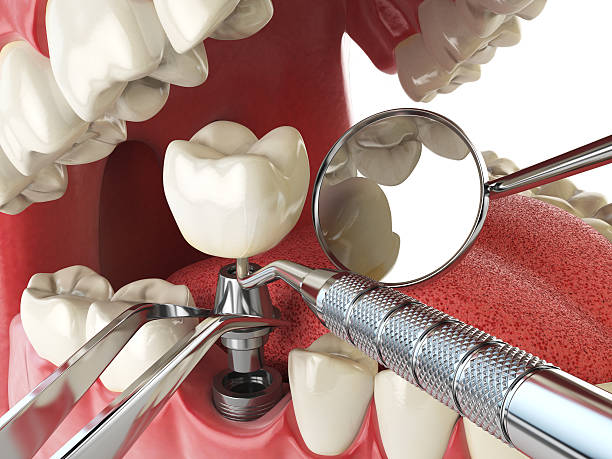 Best Mobile Emergency Dentist in Prince George, VA