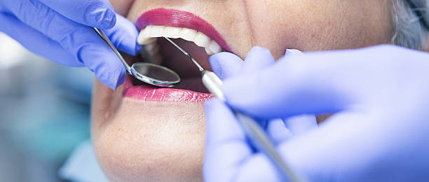 Best Emergency Dentist for Lost Fillings or Crowns in Prince George, VA
